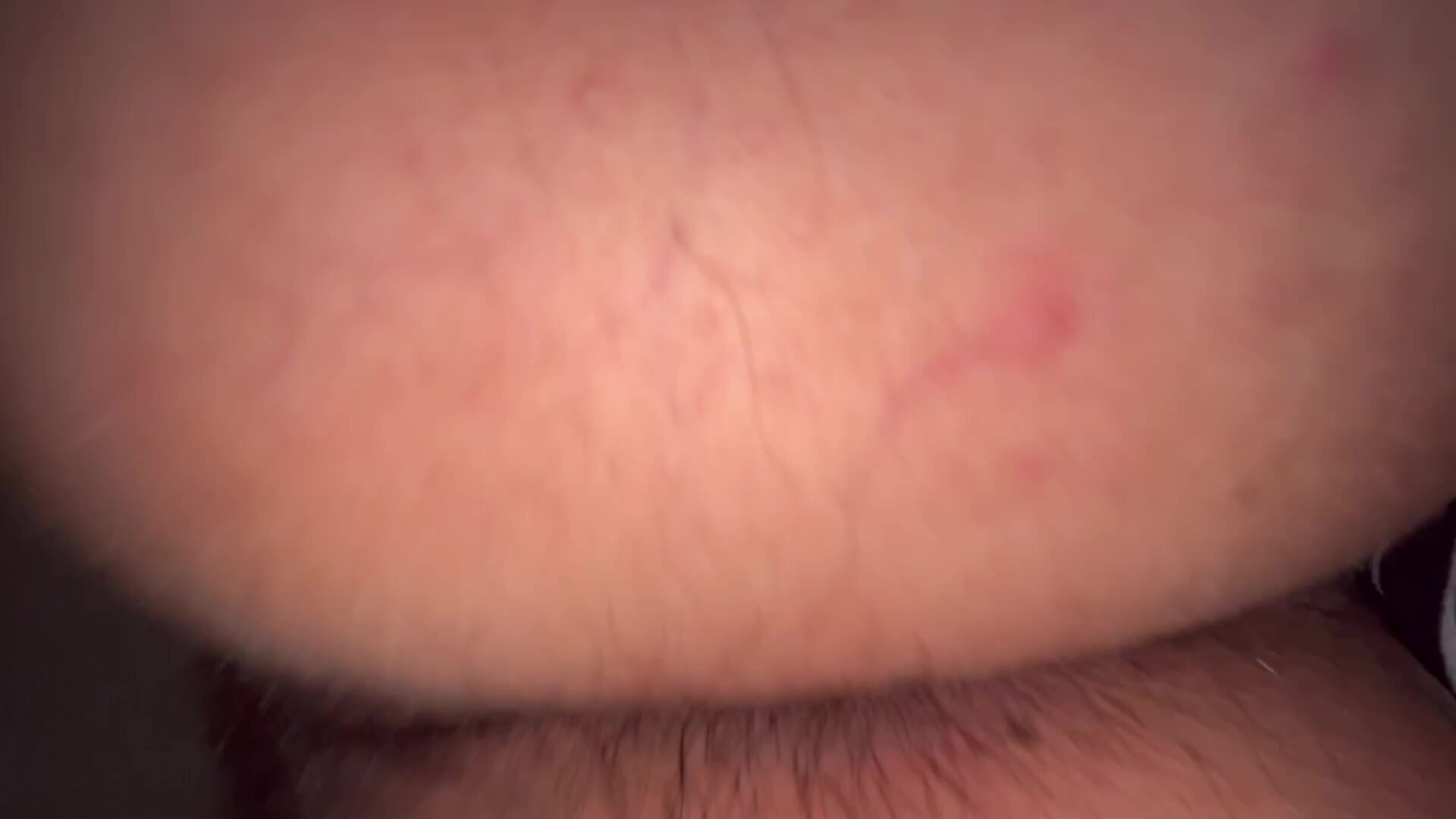 Super hairy ass